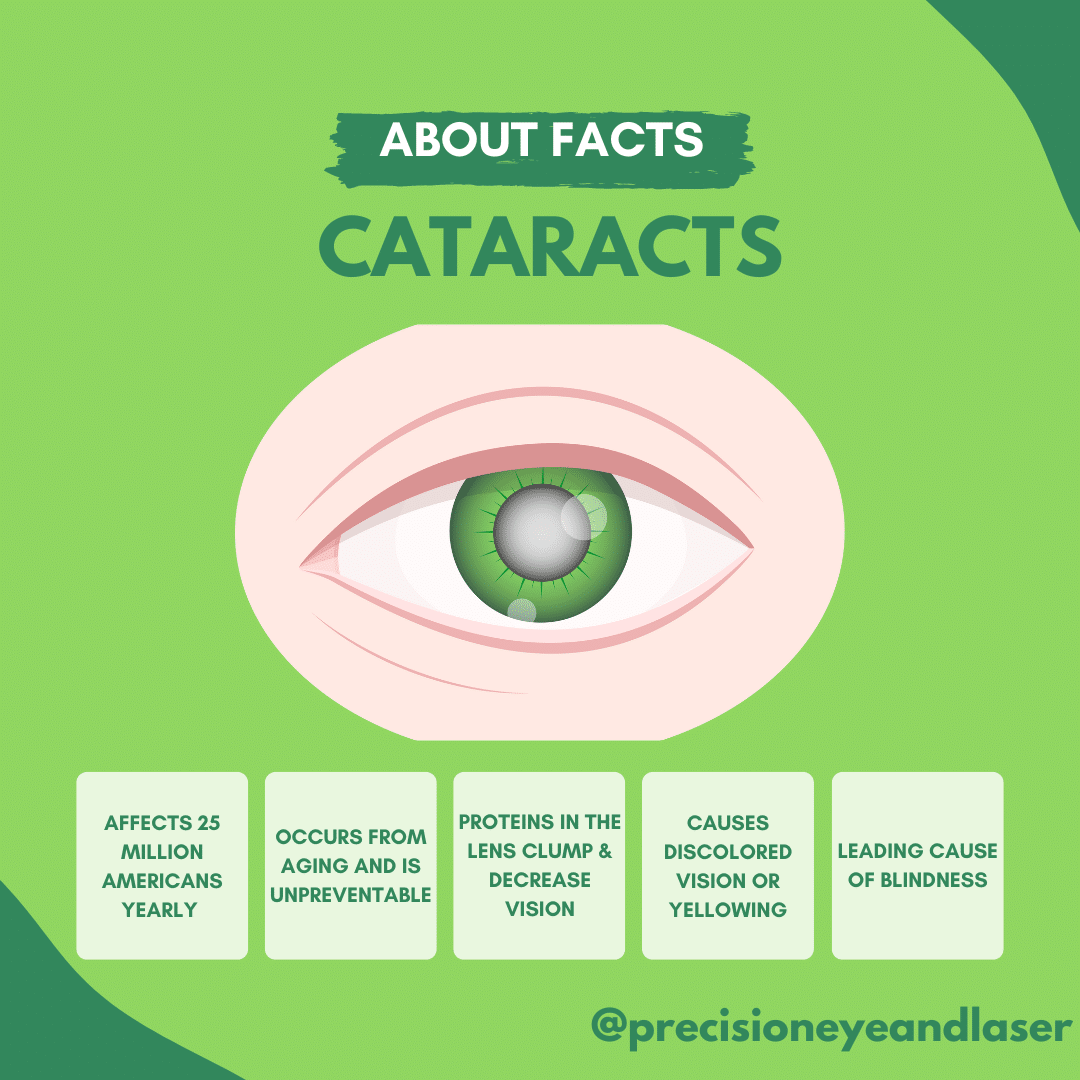 Has your eye doctor talked to you about cataracts? Don't worry, cataracts are very common and are correctable!